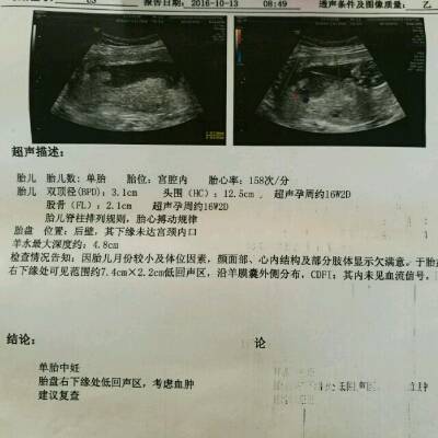 怀孕半个月肚子疼