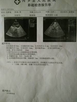 新生儿室间隔缺损