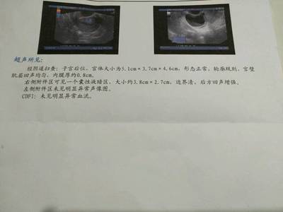 为什么没来月经也没怀孕