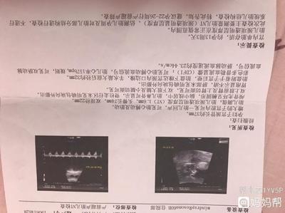 怀孕多久做nt和唐筛
