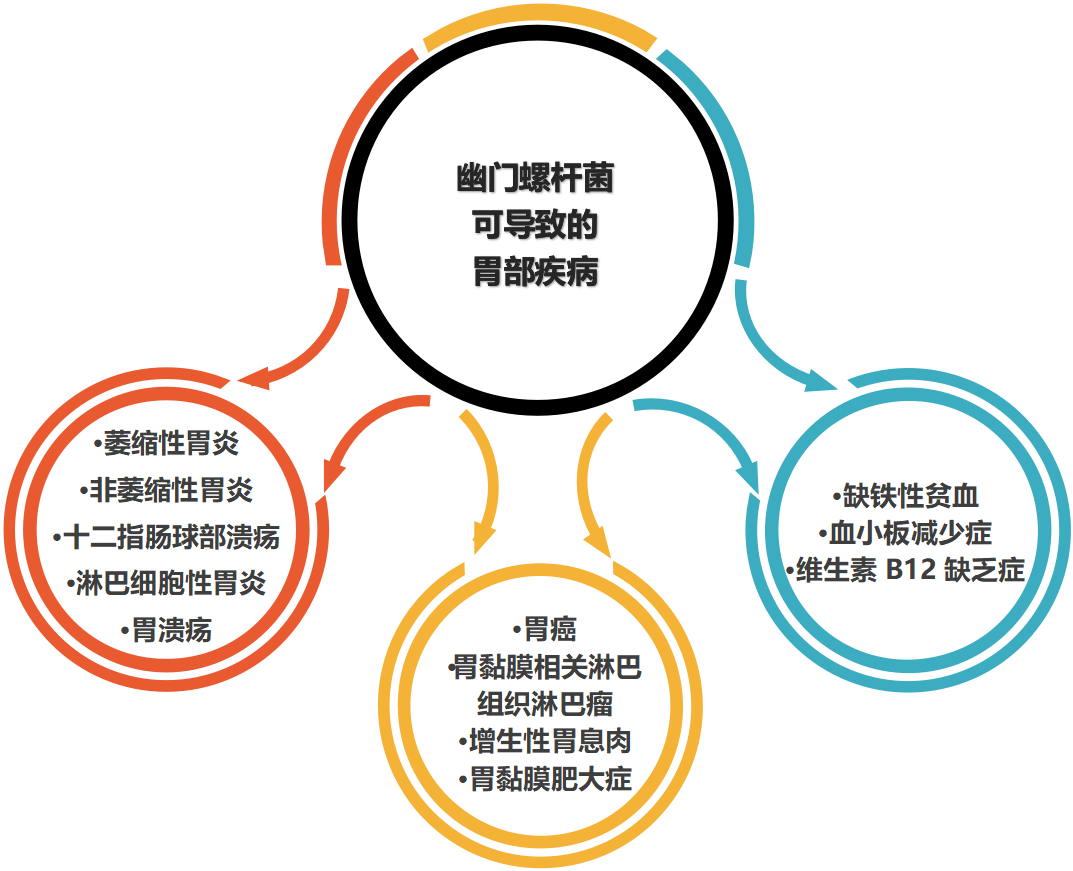 胃幽门螺杆菌感染怎么治疗