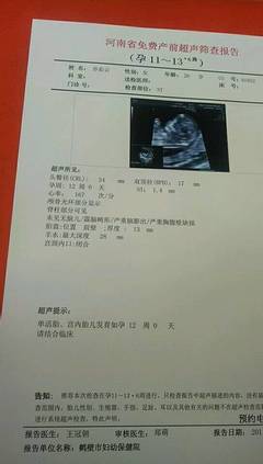 宝宝几周有胎心