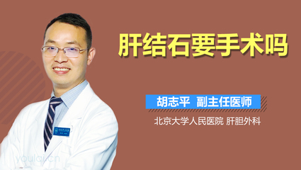 肝结石怎么治疗