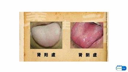痰是白色的怎么回事