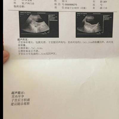 怀孕出血量