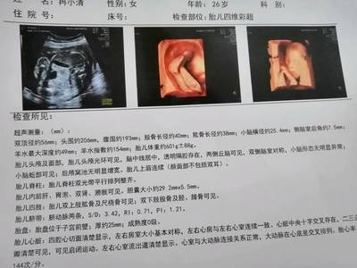 胆囊偏大是怎么回事