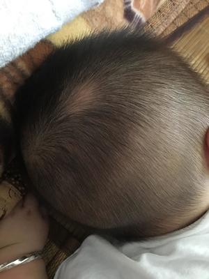 宝宝头顶头发竖起来是怎么回事