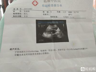 怀孕50天有胎心吗