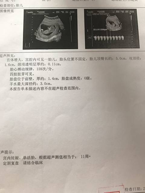 怀孕11周宝宝多大图片