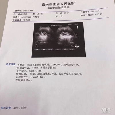 怀孕做彩超需要空腹吗