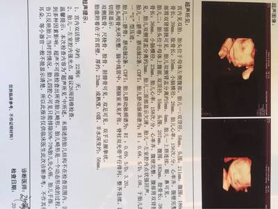 鼻子上的痘痘四个月了