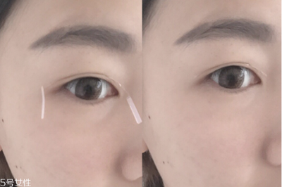 怎么剪双眼皮胶带