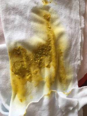 宝宝一天半没有大便了