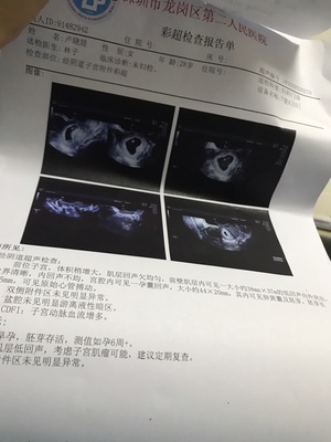 怀孕初期少量出血正常吗