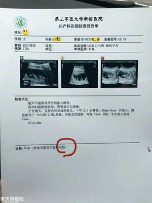 怀孕12周见红了有事吗