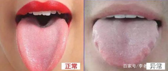 鼻子上生疮是怎么回事