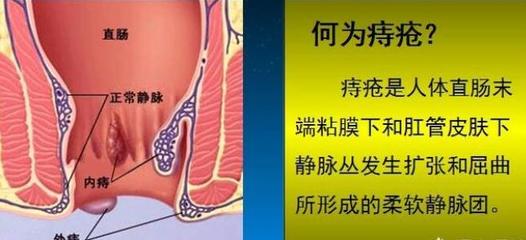 直肠疼痛是怎么回事