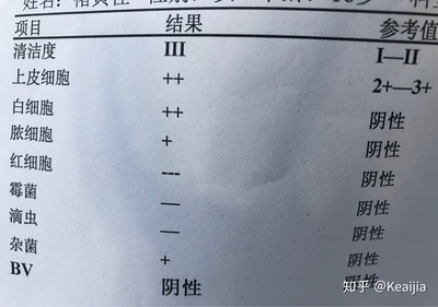 排卵期有白色豆腐渣样