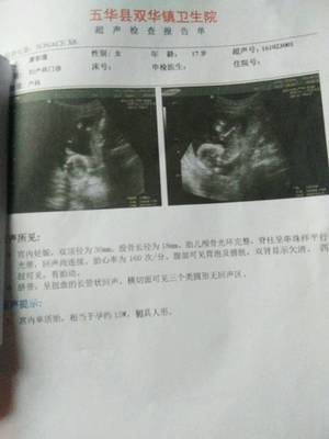 胎儿四个月有多大