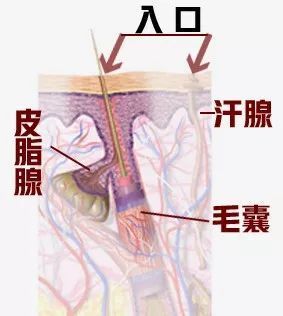 头部后面长痘痘是什么原因