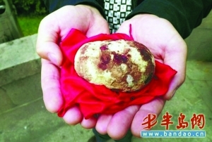 结节性囊肿痘痘怎么治疗