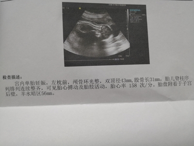 二十周的胎儿有多大