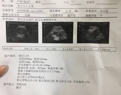 孕三十三周是几个月
