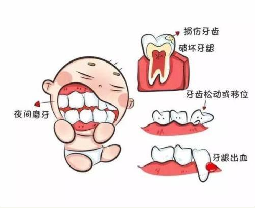 孩子磨牙是怎么回事