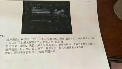 8个月头围