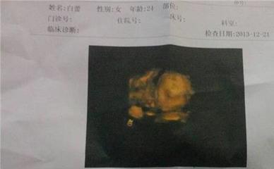 怀孕9个月是几周