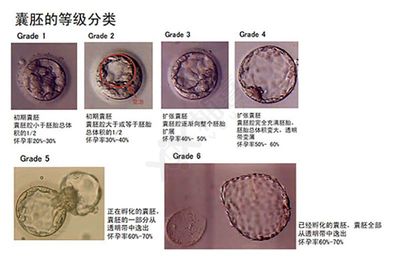 3bc囊胚相当于多少分