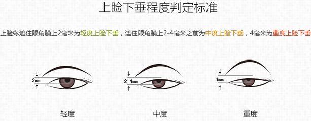 每年脸部下垂多少毫米