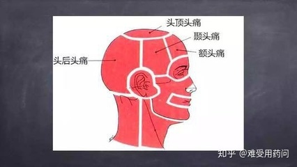 额头右边疼是怎么回事