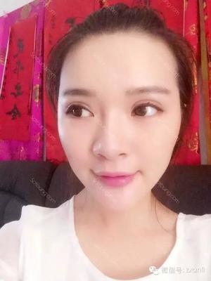 做了双眼皮发现怀孕了