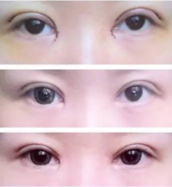 双眼皮多久可以化脸妆