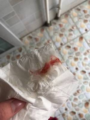 白带会怀孕吗