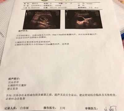 胎儿一般多久有胎心