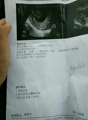 3个月的胎儿有多大