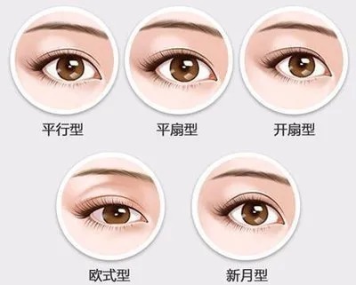 双眼皮有哪几种形状