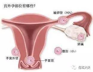 怀孕了有妇科病怎么办