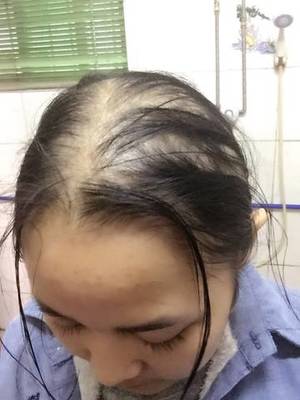 做头发后多久可以怀孕