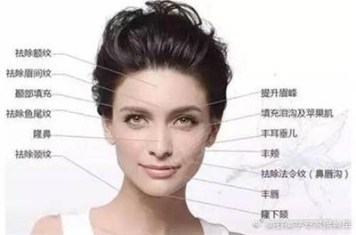 玻尿酸能去皱纹吗