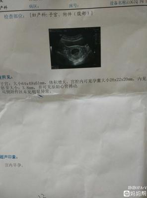 怀孕四十天需要做什么检查