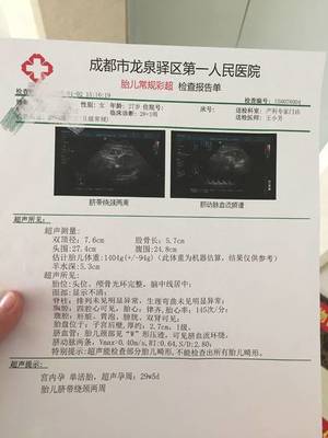 怀孕36周脐带绕颈两周怎么办