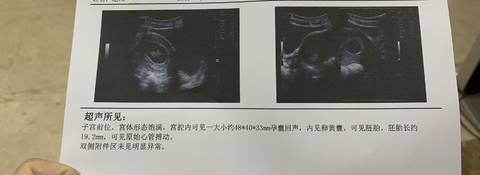 怀孕多久有心管搏动