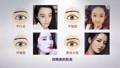 美丽的双眼皮
