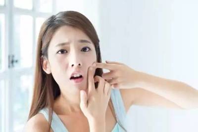 长了痘痘挤了怎么办小妙招