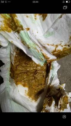 孕妇拉屎很臭