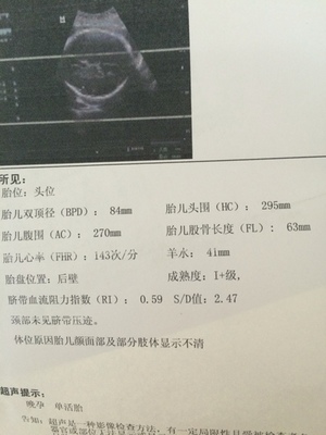 胎儿fl标准对照表