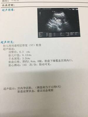 怀孕位置低